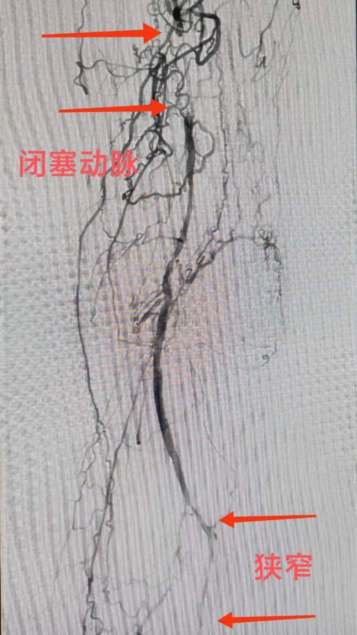 术前2.jpg