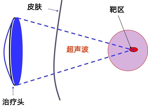 图片 1.png