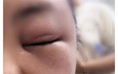 台风前后，这种情况高发！医生提醒