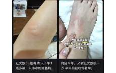 外出看见这种小土包，千万别踩！