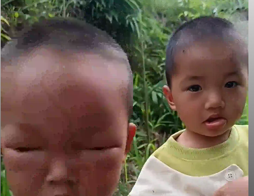 两个霸总!一个嘴总一个眼总，小孩哥玩蜜蜂被蛰得嘴歪眼肿，网友:这是卧龙凤雏还是哼哈二将