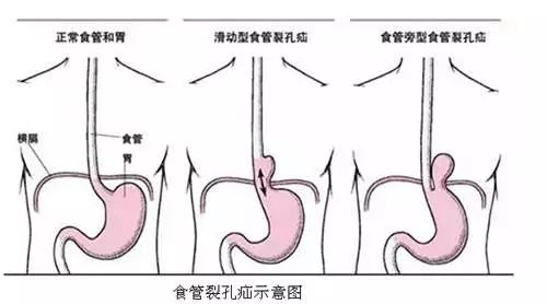 图片 4.png