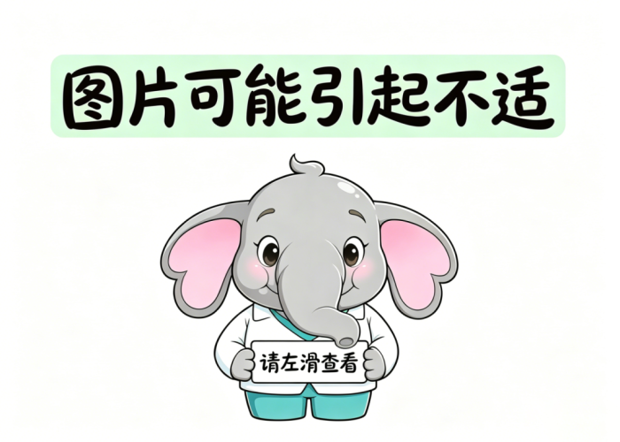 谨慎滑动.png