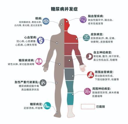 经常感到疲倦、嗜睡，总觉得饿……