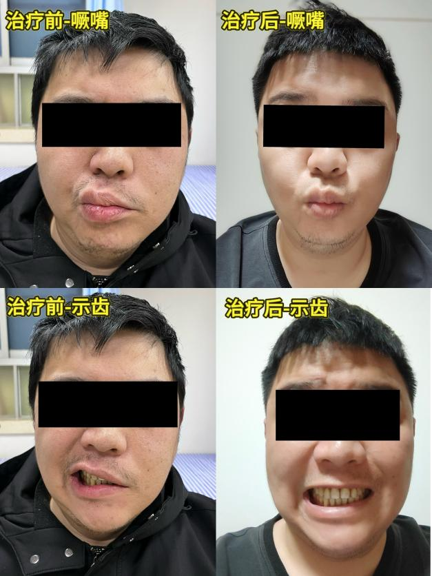图片 3.png